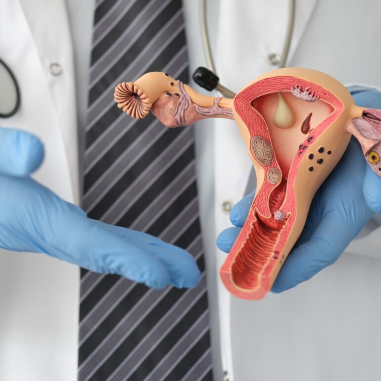 Gynaecological Oncology