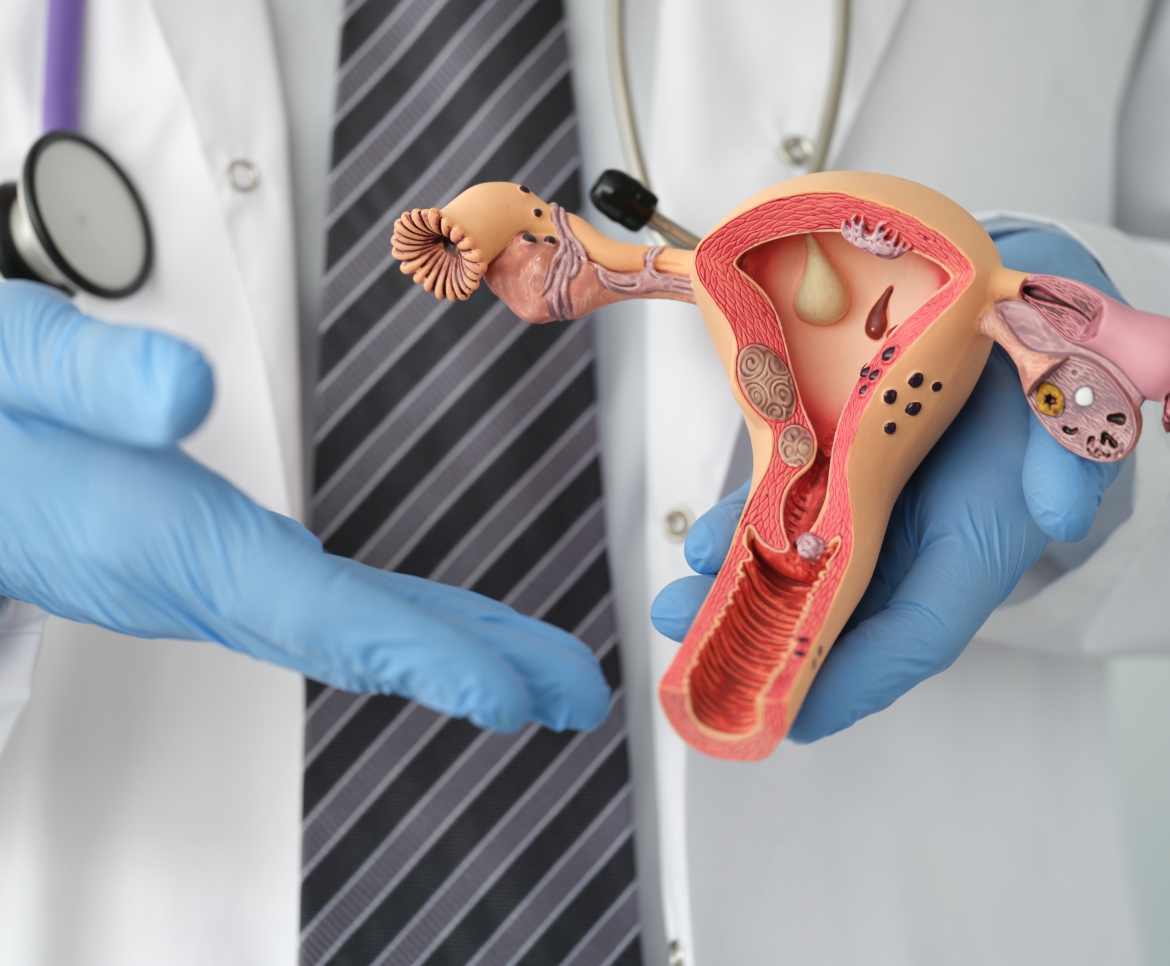 Gynaecological Oncology